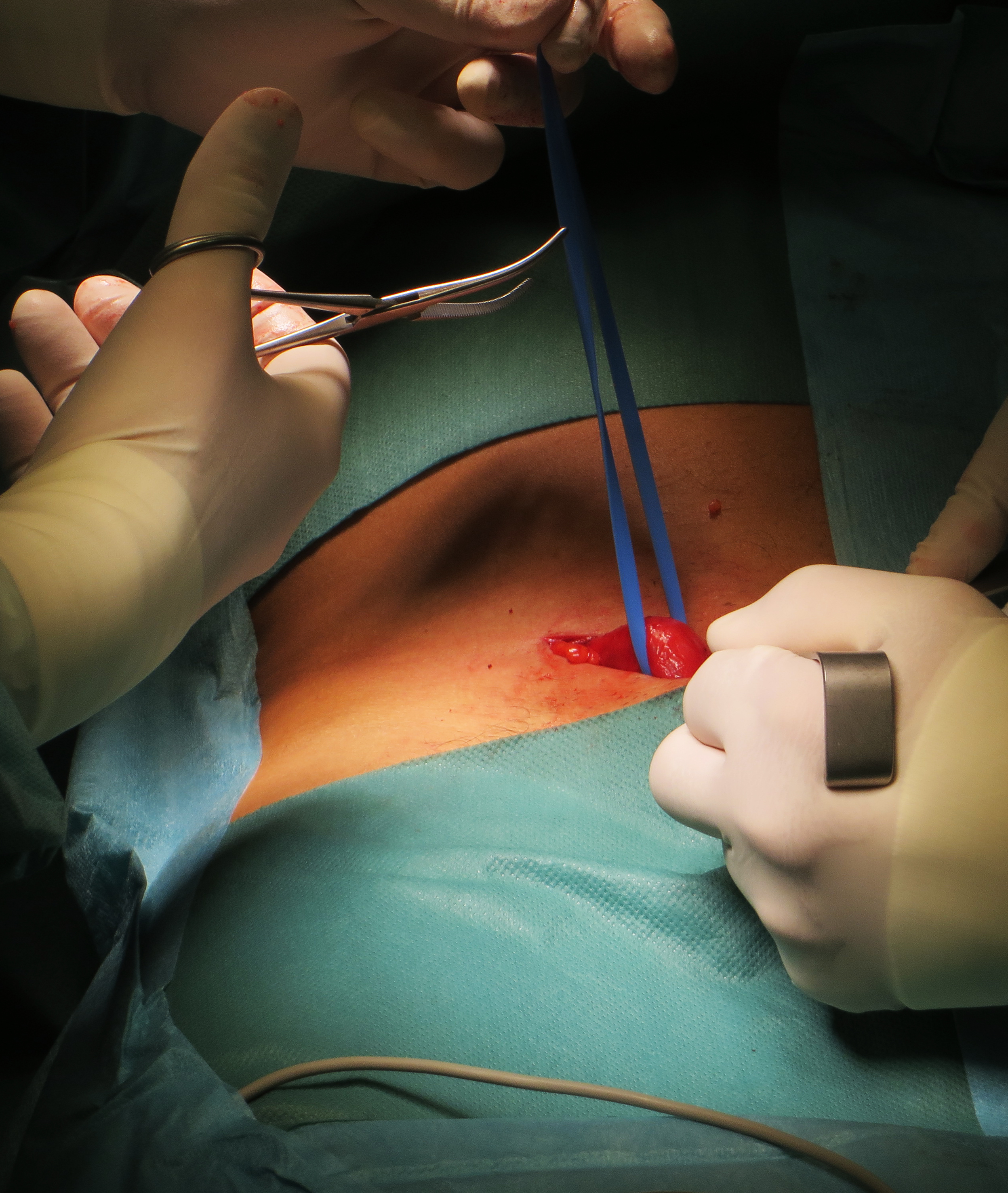 Usage during operation procedure